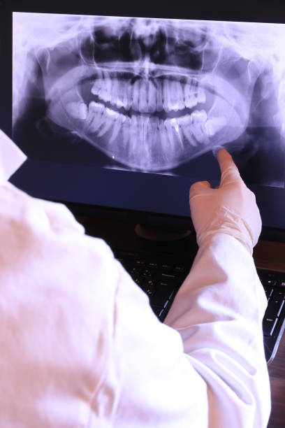 Best Emergency Dental Care for Abscessed Tooth in Willards, MD